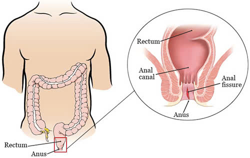 Ý nghĩa của anal là gì?